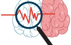 Рассеянный склероз: все, что нужно знать о жизни с диагнозом и современной диагностике